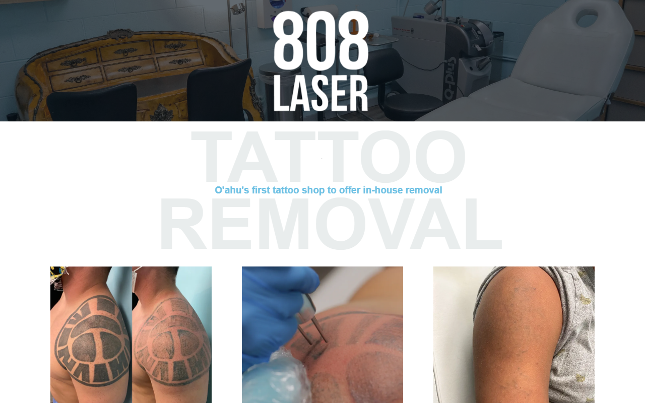 808tattooremoval.com screenshot